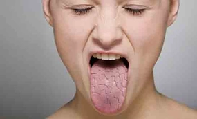 Boğaz Kuruluğu Belirtileri ve Tedavisi